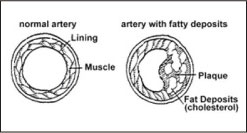 Inside of Artery - Section