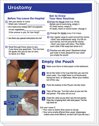 Urostomy Instructions